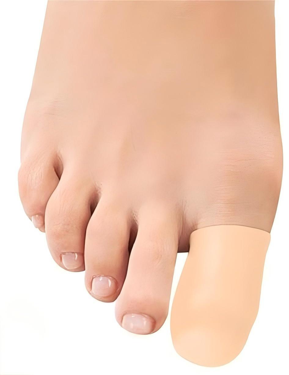 (10 Pcs) Gel Toe Caps - Protectors for Ingrown Toenails, Corns, and Blisters - BPRunning