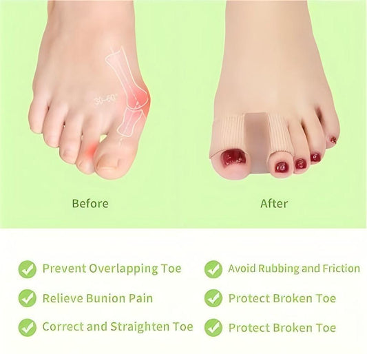 (2 Pcs) Gel Bunion Toe Separators - Breathable Protectors for Overlapping Toes - BPRunning